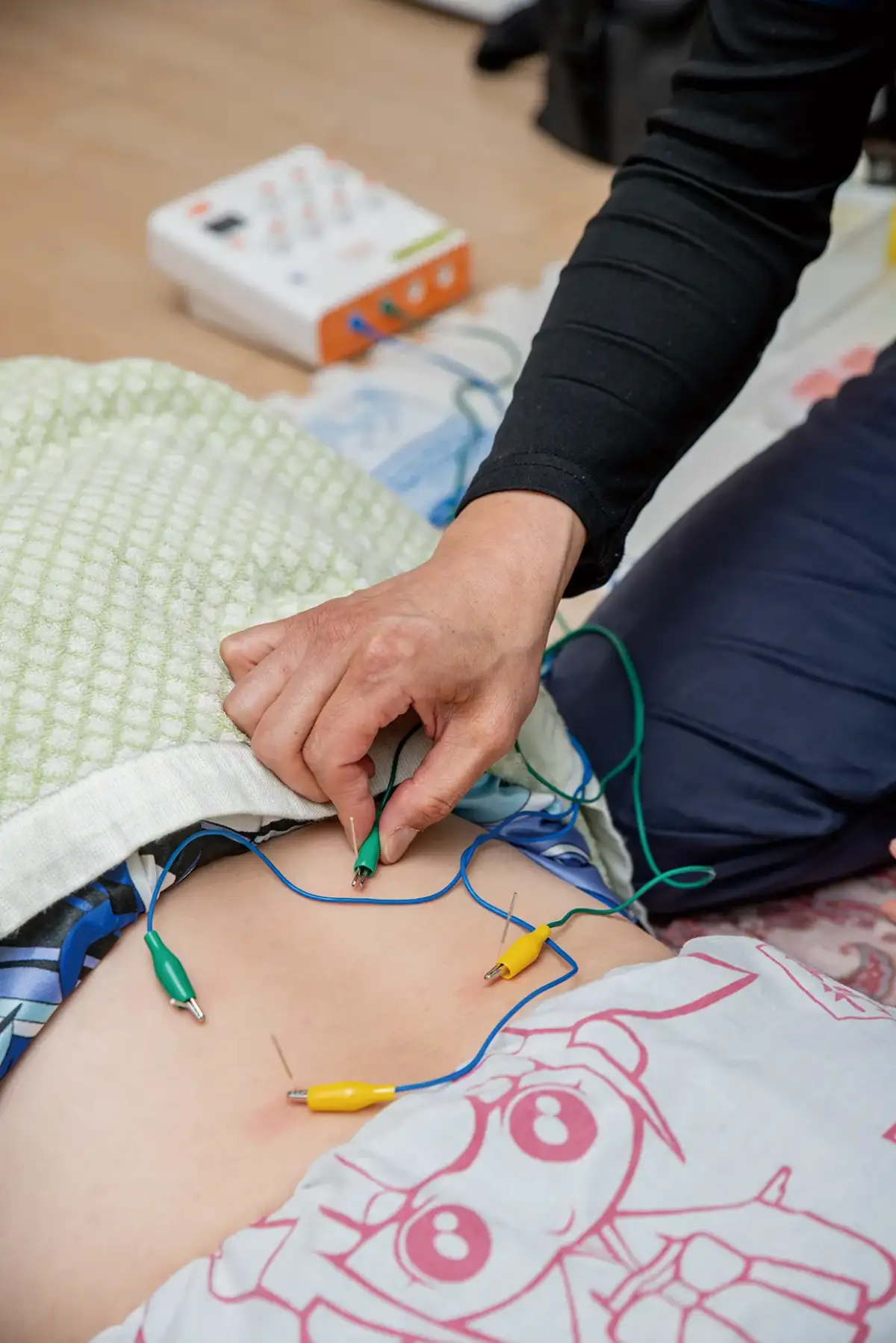 腰部に鍼通電を行う訪問鍼灸施術